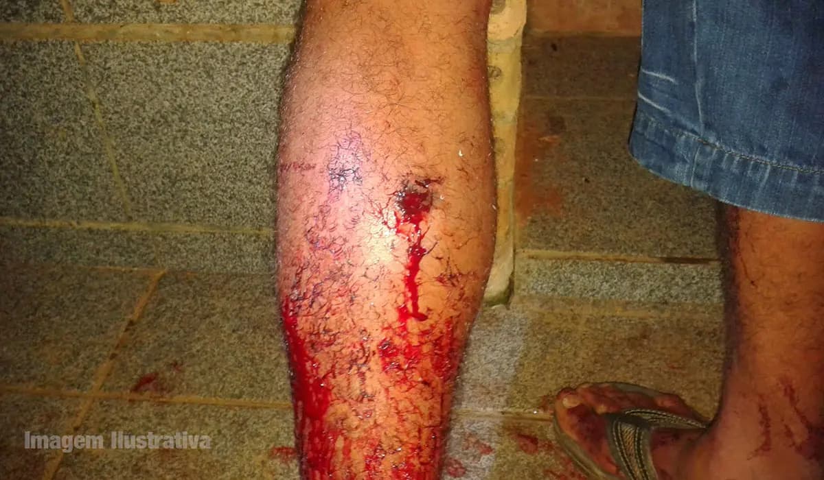 Homem é Ferido por Disparo de Arma de Fogo em Cornélio Procópio