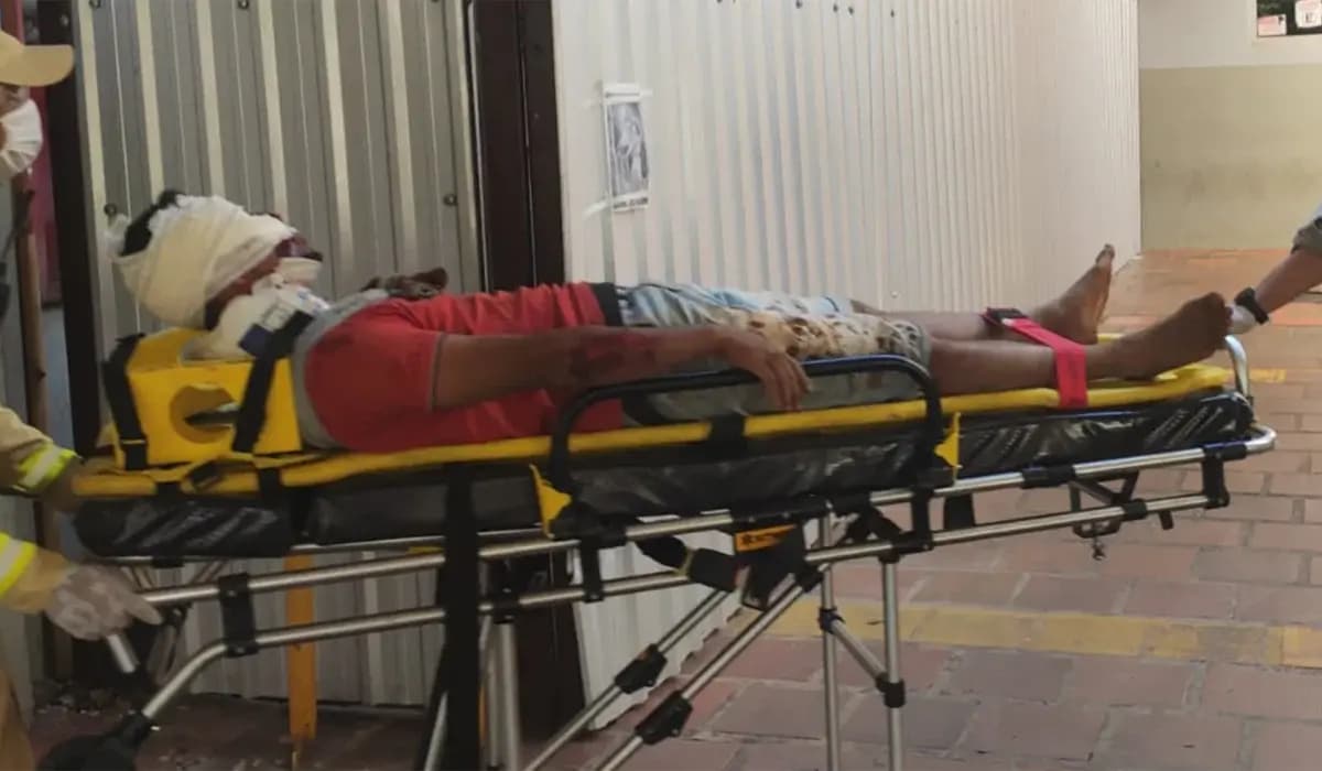 Acidente em estrada rural resulta em grave ferimento em motociclista