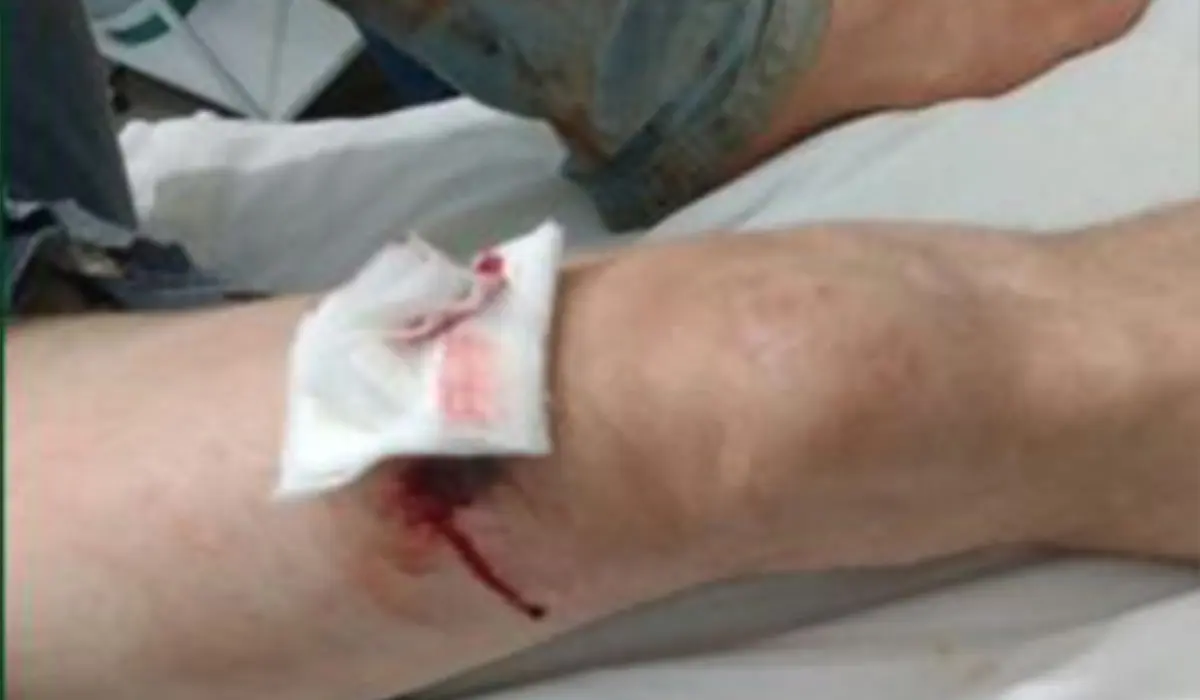 Homem é baleado na perna em Cornélio Procópio